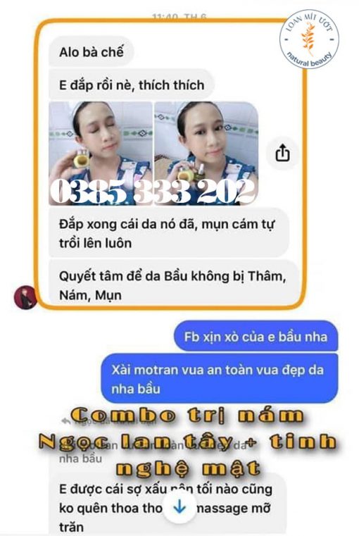 Review Tinh nghệ mật N'store by Thanh Nhi