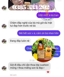 Review Tinh nghệ mật N'store by Thanh Nhi